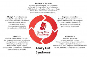 Leaky Gut Syndrome F